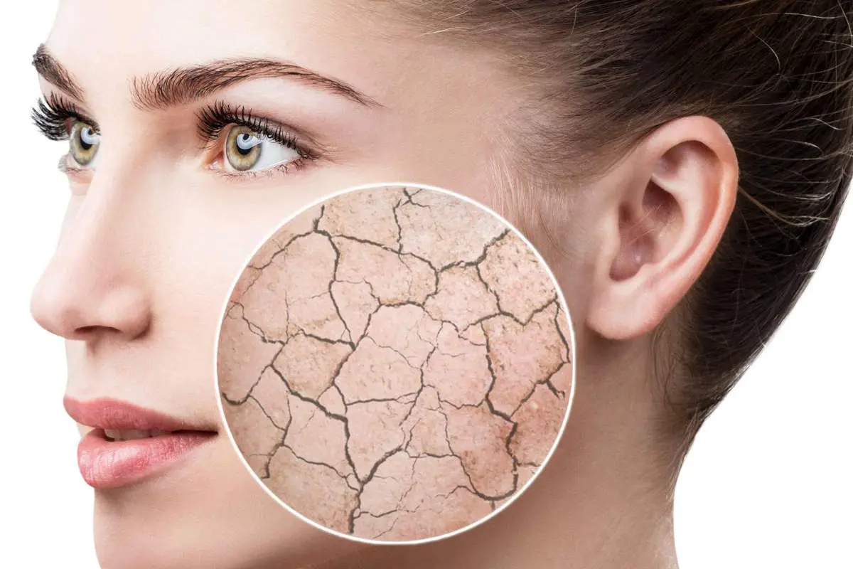 اگر این مواد را مصرف می‌کنید خشکی پوست در کمین شماست