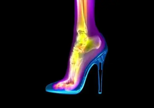 آیا پوشیدن کفش پاشنه‌بلند ساختار پا را تغییر می‌دهد؟