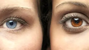 هشدار درباره عمل زیبایی که می‌تواند نابینا کند
