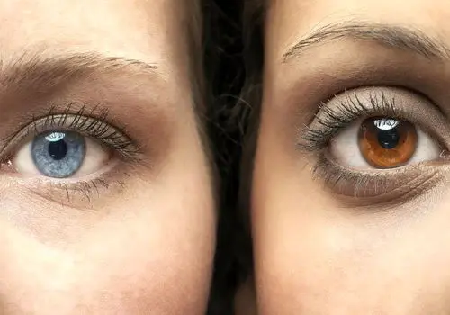 هشدار درباره عمل زیبایی که می‌تواند نابینا کند
