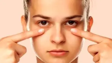 چند راهکار فوری برای رفع پف زیر چشم