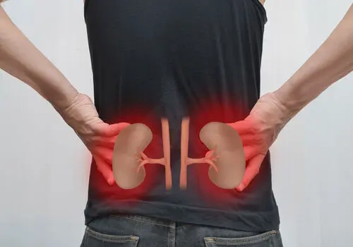 ساده ترین راه برای جلوگیری از سنگ کلیه
