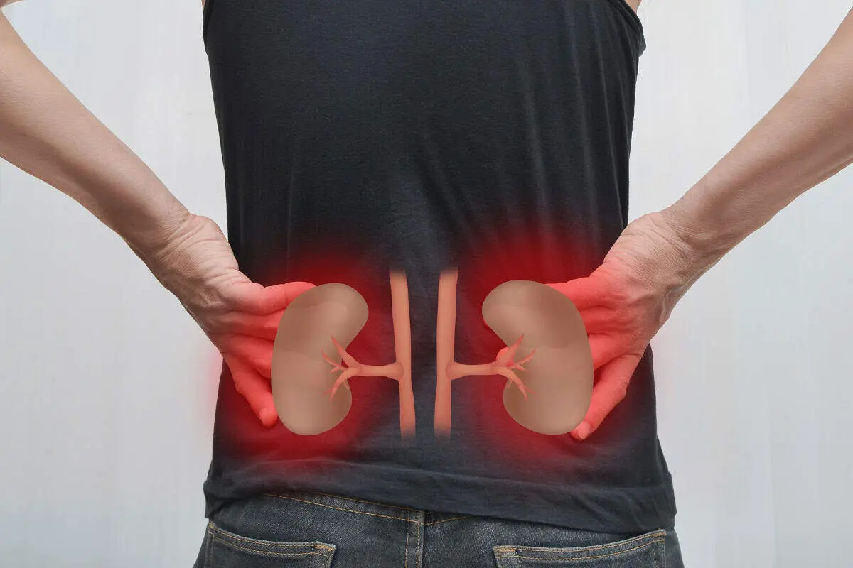 راهکار پیشگیری از گرفتن سنگ کلیه 