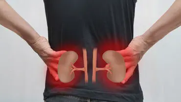 راهکار پیشگیری از گرفتن سنگ کلیه 