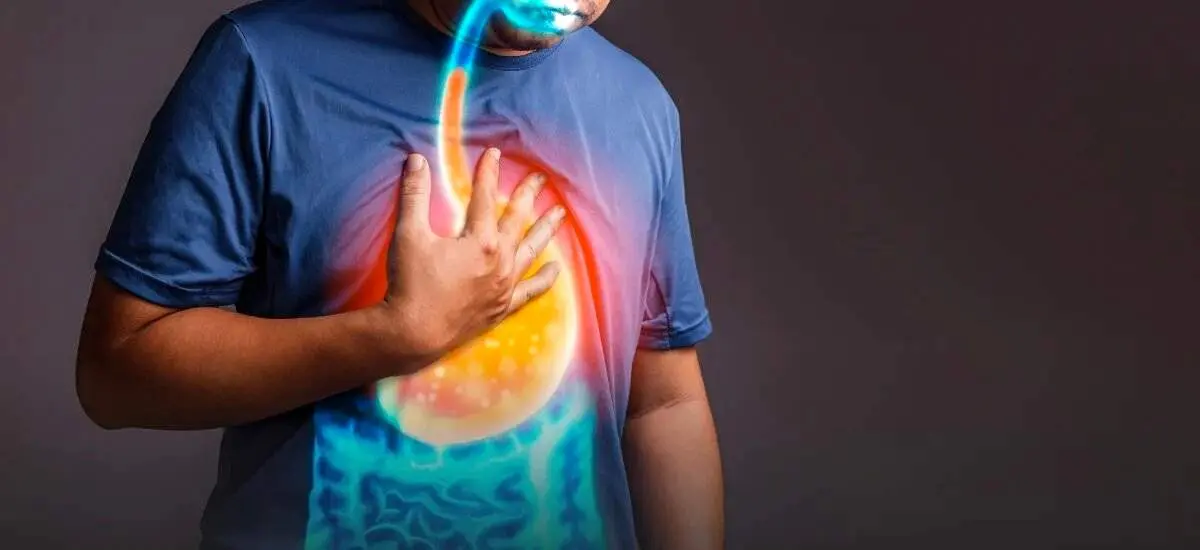 غذاهای سودمند برای تسکین سوزش سر دل