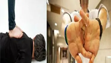 آیا شکستن قولنج خطرناک است؟