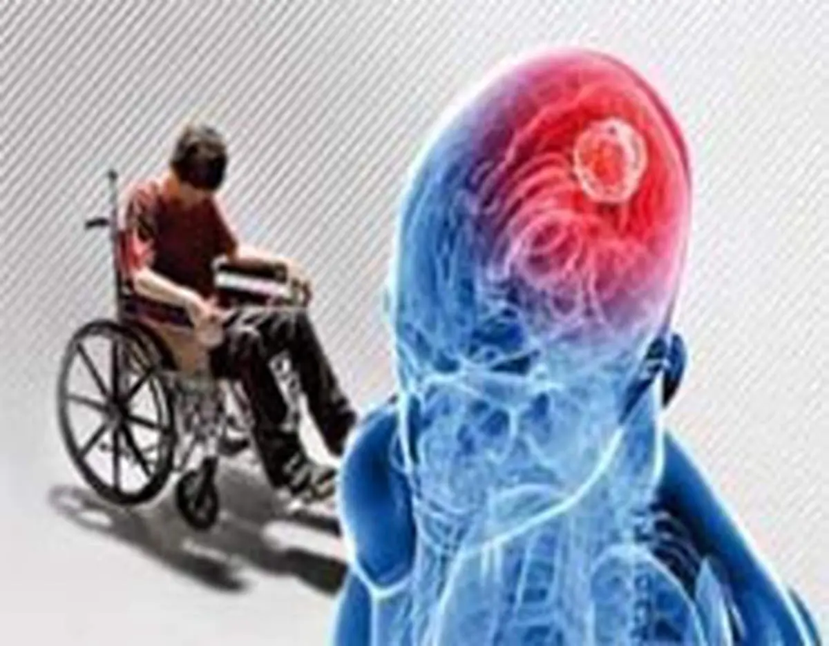 رابطه عصبانیت با «MS»