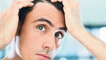راهکاری برای ریزش موی آقایان