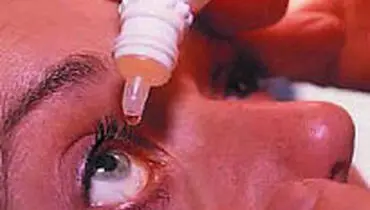 سندرم خشکی چشم، علل و درمان