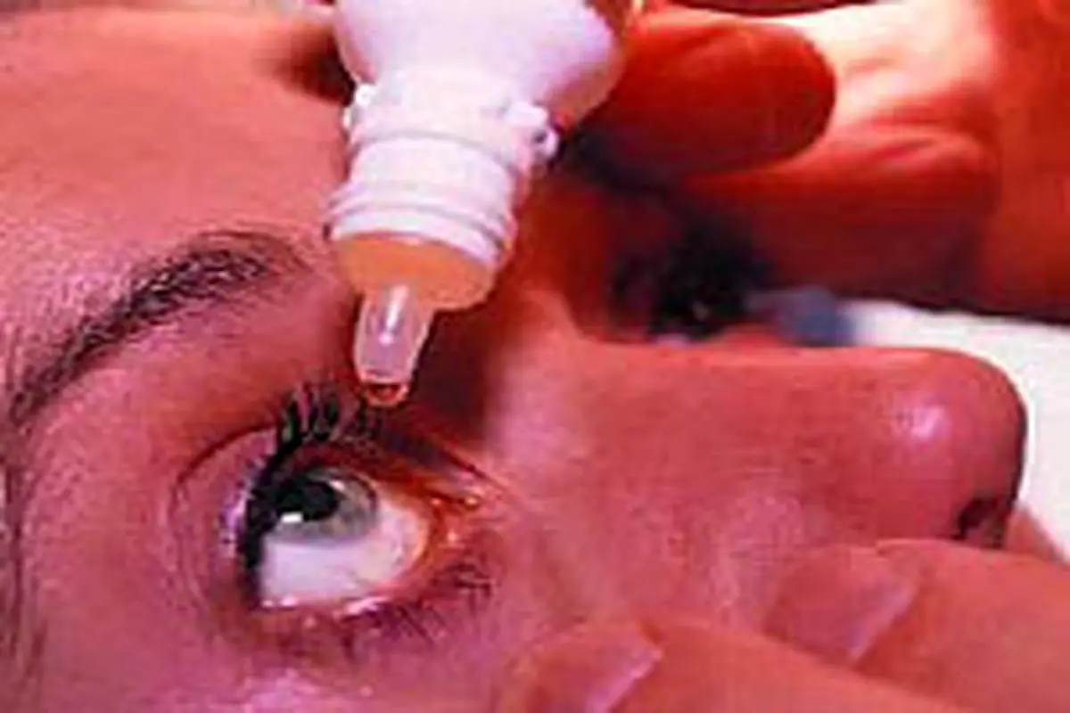 سندرم خشکی چشم، علل و درمان