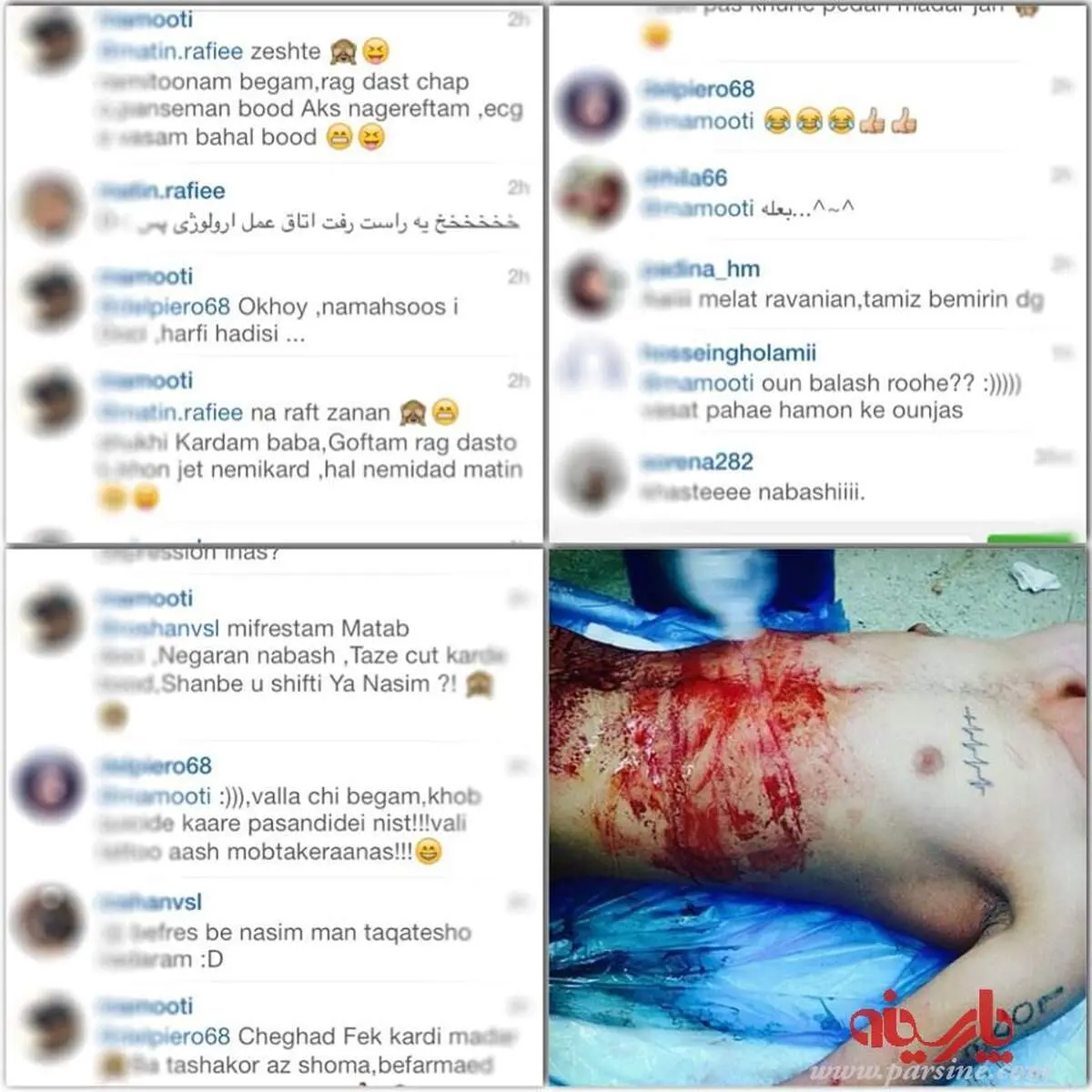 یک حادثه شرم آور در جامعه پزشکی؛ اینستاگرام بازی با بدن بیمار!
