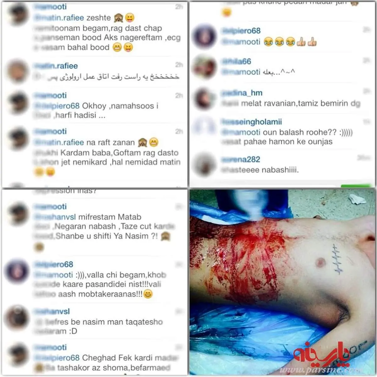 یک حادثه شرم آور در جامعه پزشکی؛ اینستاگرام بازی با بدن بیمار!