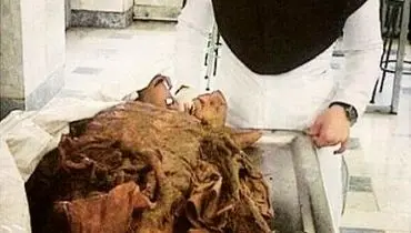 عکس یادگاری دانشجویان پزشکی با جسد در سالن تشریح!