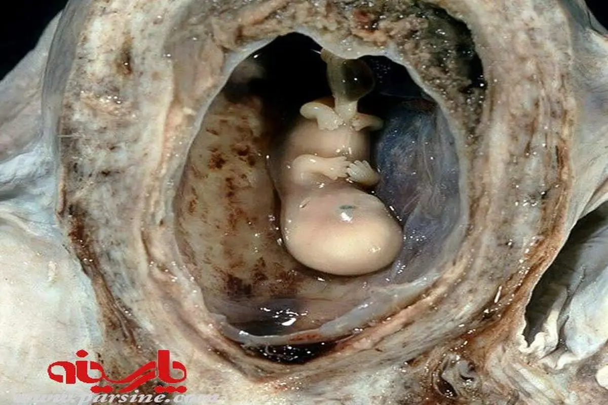 عکس:جنین چهارده هفته ای درون رحم