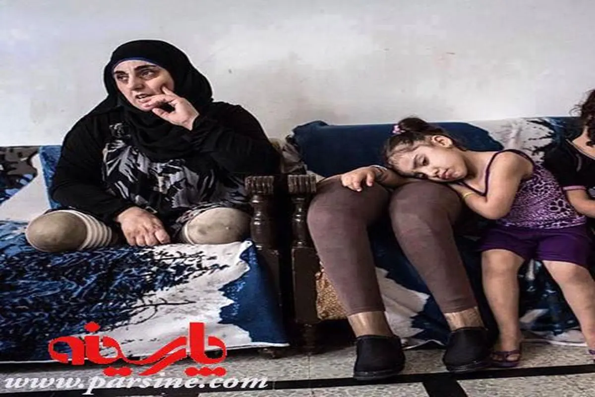 عکس:کودک سوری و پاهای مصنوعی مادر