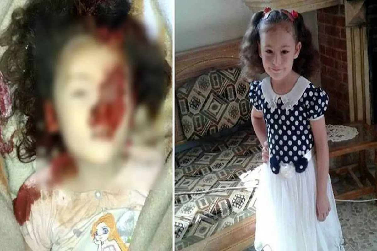 عکس:دختر بچه سوری که در حملات هوایی روسیه کشته شد