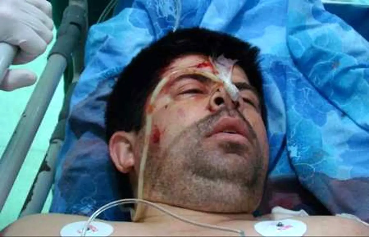 دستگیری یکی از2ضارب اصلی محیط بانان گرگانی
