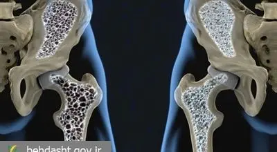 نقش تمرینات هدفمند در حفظ سلامت استخوانها و پیشگیری از پوکی استخوان