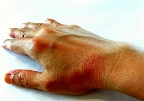 از قلب تا روده؛ رازهای پنهان چای سیاه در بدن شما