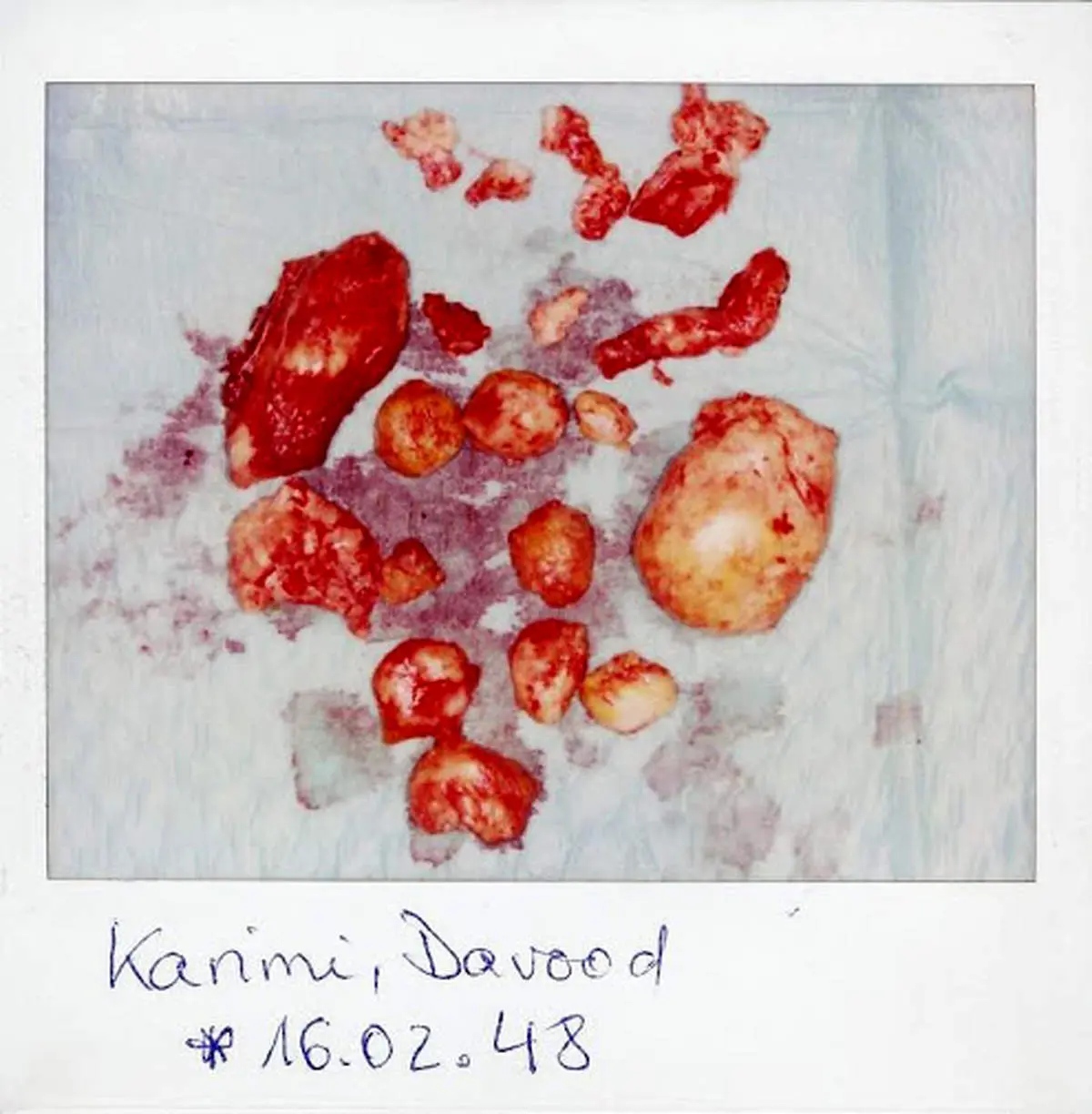 ذخیره های آخرت   در شانه "حاج داوود"  + عکس