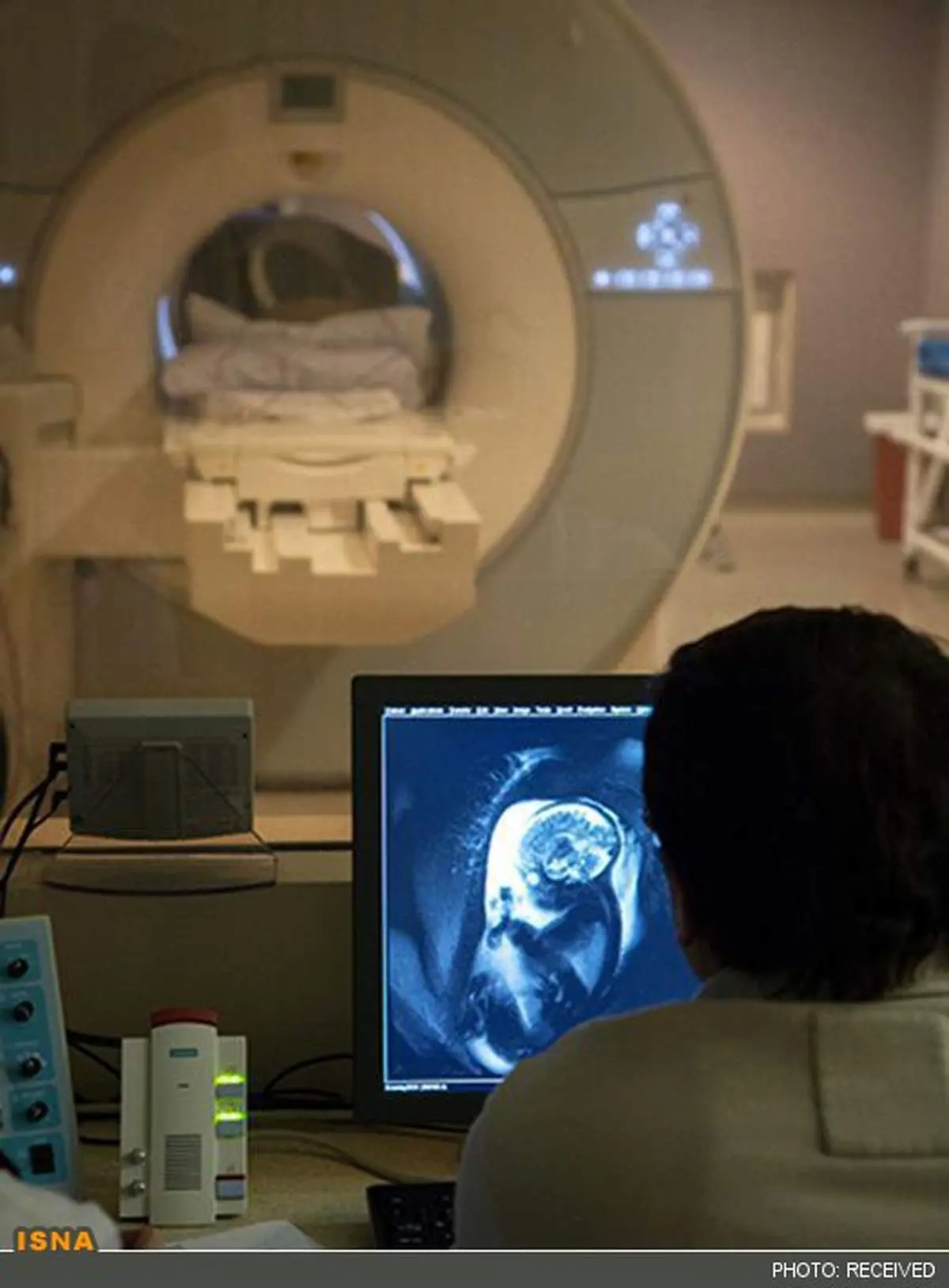 نخستین تصاویر MRI از فعالیت مغز جنین