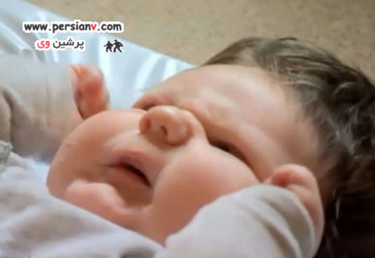 مادری که از تولد نوزاد عجیبش متحیر شد +تصاویر