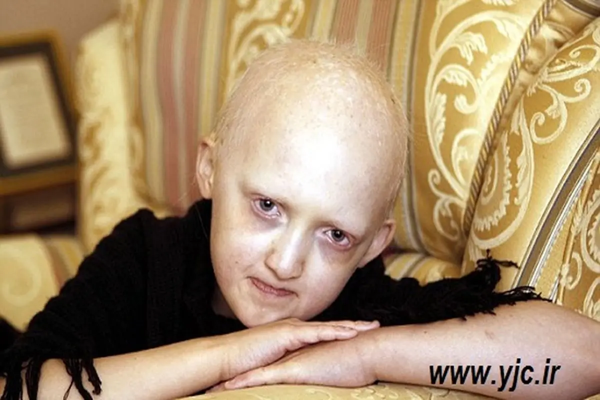دختری که زندگی اش به کولروصل است! +عکس