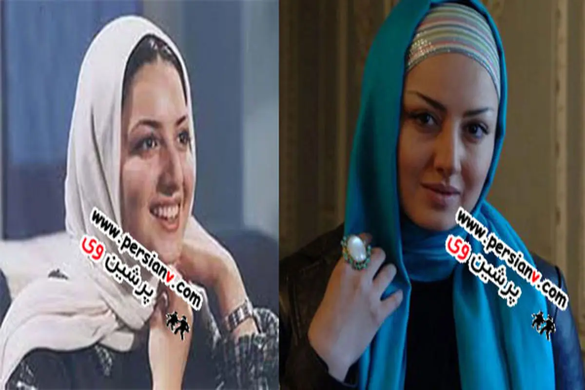 عکس/برخی بازیگران مشهور ایرانی قبل و بعد از جراجی بینی