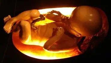 تولد اولين نوزاد در يک لوله آزمايش+عكس
