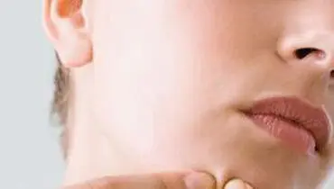 راه هایی فوق العاده برای بهبود جوش های صورت
