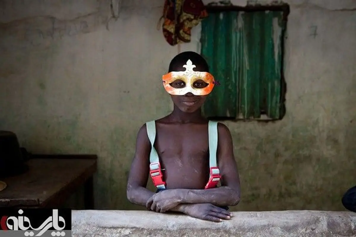 عکس/ چهره جالب پسر گامبیایی