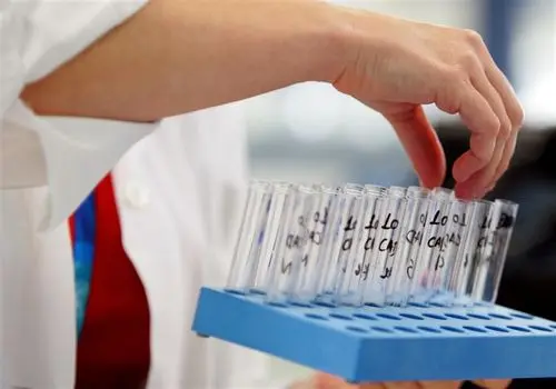 اوسمار: خودمان هم استرس می‌گیریم!