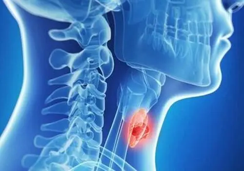 این علائم کم‌کاری تیروئید را جدی بگیرید