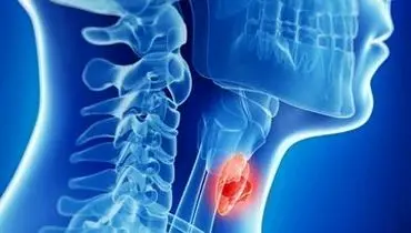 بهترین مواد غذایی برای نجات تیروئید