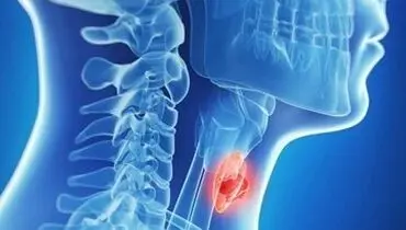 بهترین مواد غذایی برای نجات تیروئید