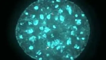 اولین تصویر میکروسکوپی از عامل سرطان