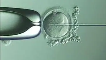 تاملی حقوقی در برخی ابعاد مسئله درمان ناباروری
