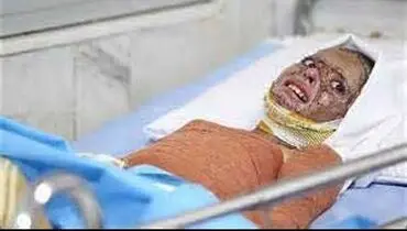 دختری که نمی‌تواند در آیینه نگاه کند