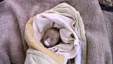 عکس:نوزاد سوری که بر اثر گرسنگی جان داد