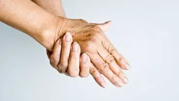 قصه تلخ قطع دستان زن توسط شوهرش + فیلم