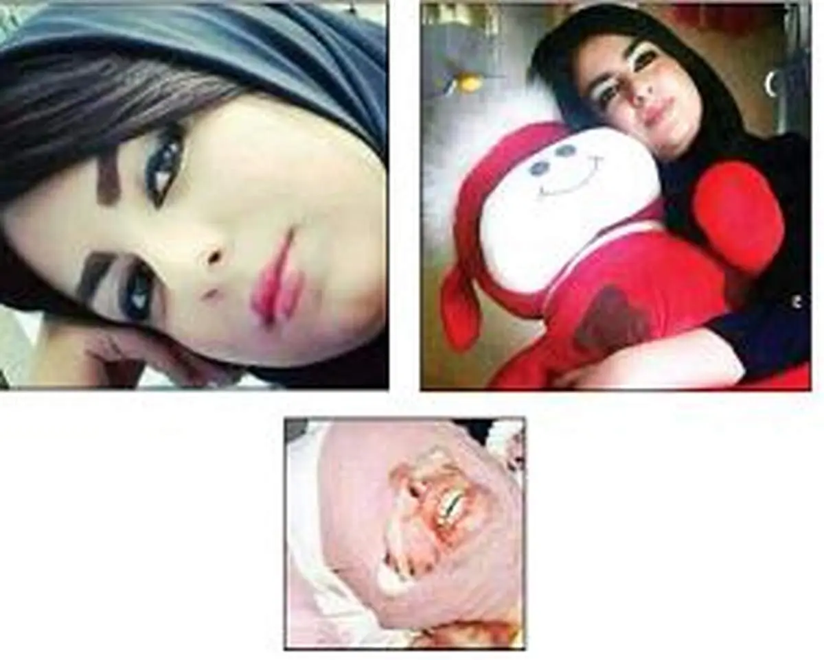 اسیدپاشی بر صورت دختر مورد علاقه همسر +عکس