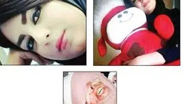 اسیدپاشی بر صورت دختر مورد علاقه همسر +عکس