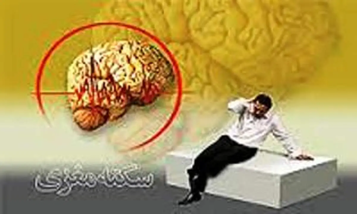 کاهش سن سکته مغزی کشور