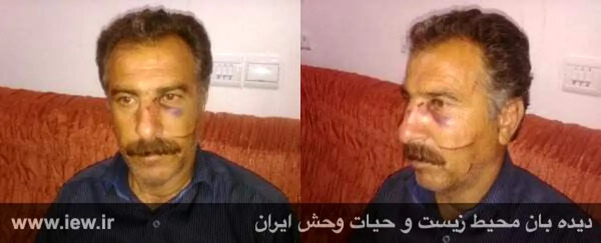 جراحت شدید محیط بان با ضربات چوب و چاقوی شکارچیان+عکس