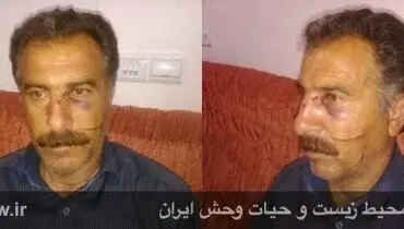 جراحت شدید محیط بان با ضربات چوب و چاقوی شکارچیان+عکس