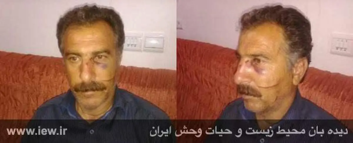 جراحت شدید محیط بان با ضربات چوب و چاقوی شکارچیان+عکس