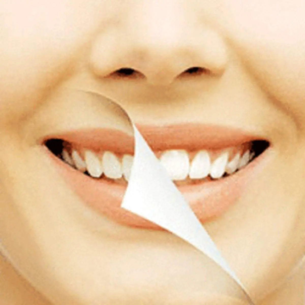  چرا دندان جرم میگیرد؟
