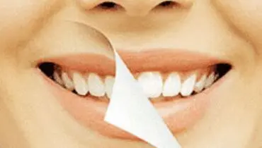 ‭ ‬چرا‭ ‬دندان‭ ‬جرم‭ ‬می‌گیرد؟
