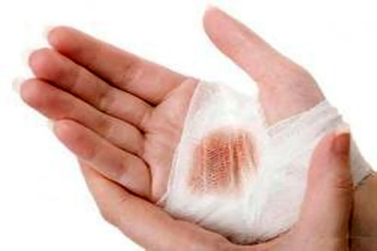 خلاصهای از احکام جبیره در وضو