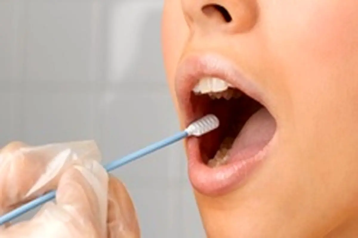 مهمترین علل سرطان دهان را بشناسید